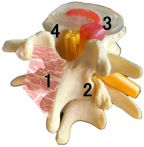 筋、脊椎関節、椎間板、脊柱管、由来腰痛