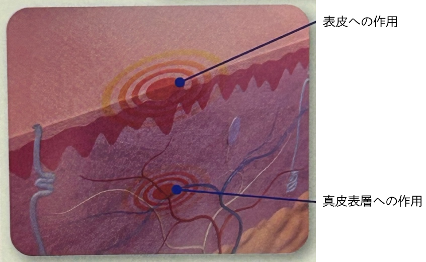 表皮への作用、真皮表層への作用