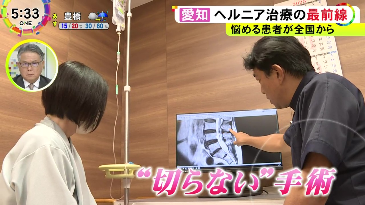 極小の侵襲でヘルニアの治療を行う「SELD」手術について